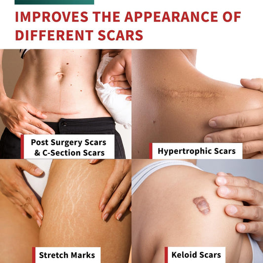Cinta Silicona Elimina Cicatriz
