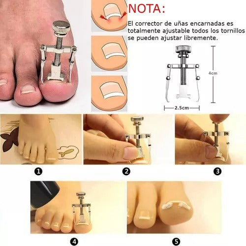 Set Para Uñas Encarnadas Kit De Manicure Pedicure 12 Piezas